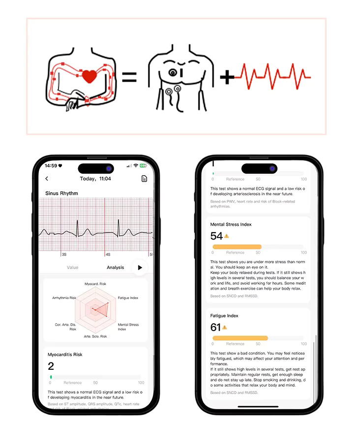Смарт-часы Lemfo ET491 с функцией ЭКГ звонков и управлением камерой